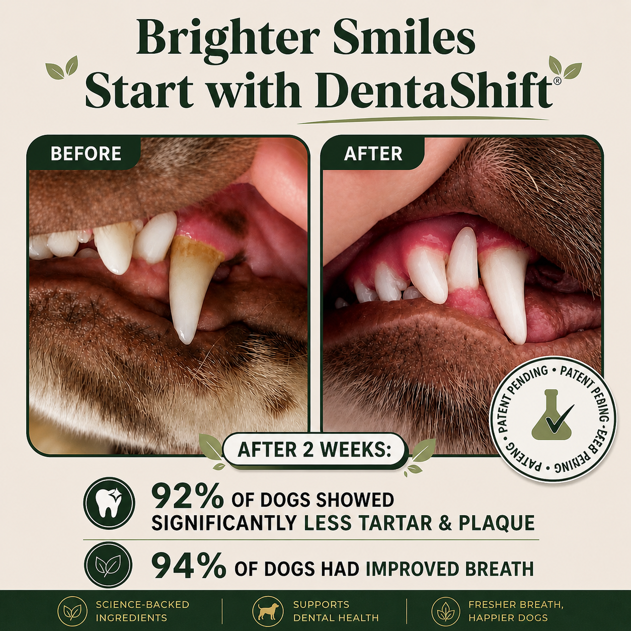 DentaShift